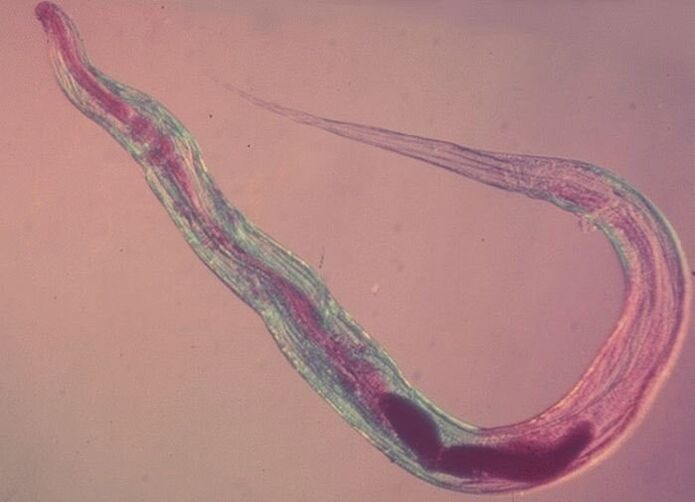 Mikroskop ostida pinworm
